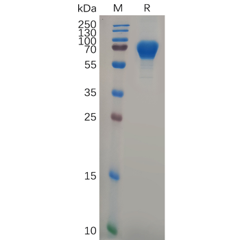 Human CCR4 (1-39) Protein, hFc Tag