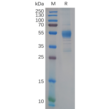 Human CEACAM6 Protein, His Tag