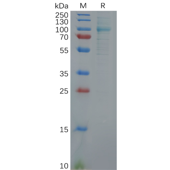 Human IL4RA Protein, hFc Tag
