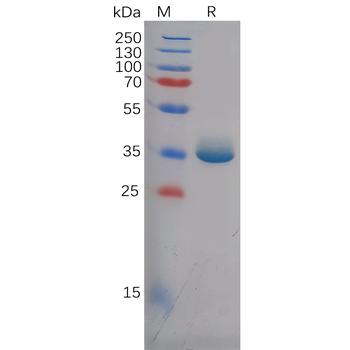 Human CDH3 Protein, His Tag