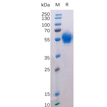 Human NCL Protein, His Tag