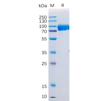 Human CD33(140-259) Protein, hFc Tag