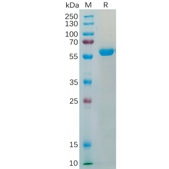 SARS-CoV-2 (Omicron) Nucleocapsid, C-His Tag