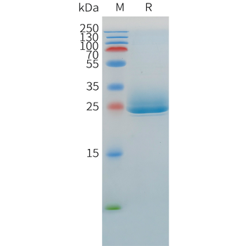 Human TENM4 Protein, His Tag