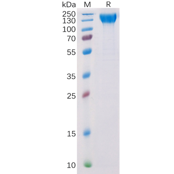 Human CD93 Protein, His Tag