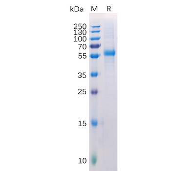 Human CDH1 Protein, hFc Tag