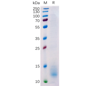 Human CD32A (H167) Protein, hFc Tag