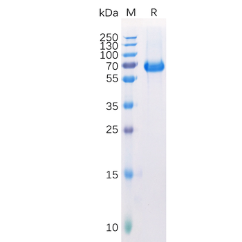 Human CD166 Protein, His Tag