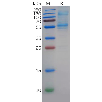 Human Her2 Protein, hFc Tag