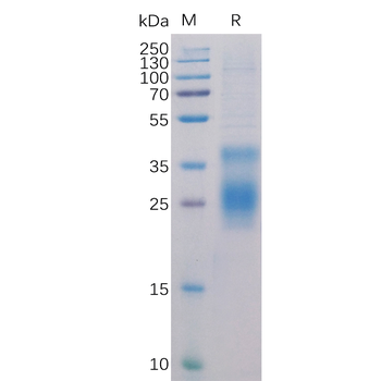 Human CD164 Protein, hFc Tag
