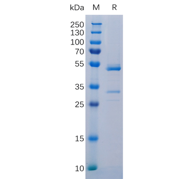 Human FZD10 Protein, hFc Tag