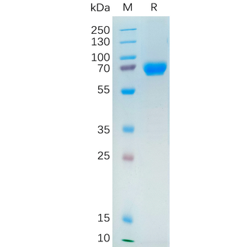 Human BST1 Protein, hFc Tag