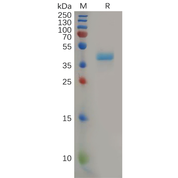 Human GHR Protein, hFc Tag