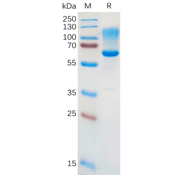 Human APCDD1 Protein, His Tag