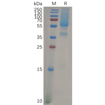 Human GDF15 Protein, hFc Tag