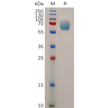Human EPHA5 Protein, His Tag
