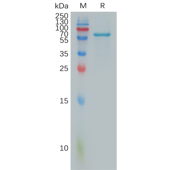 Human CXCL4 Protein, hFc Tag