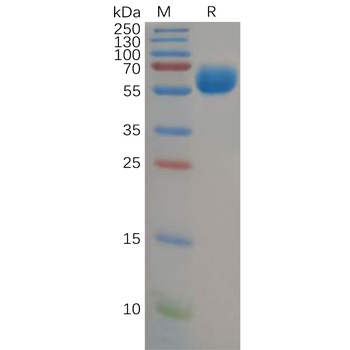 Human CRTAM Protein, His Tag