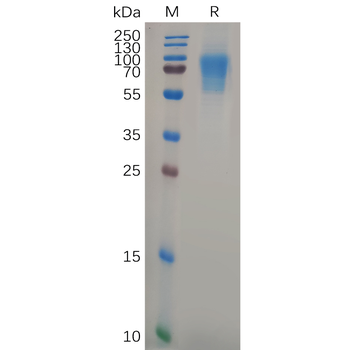 Human CLU Protein, His Tag