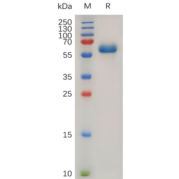 Human CD5L Protein, His Tag
