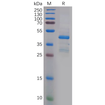 Human UPA Protein, His Tag