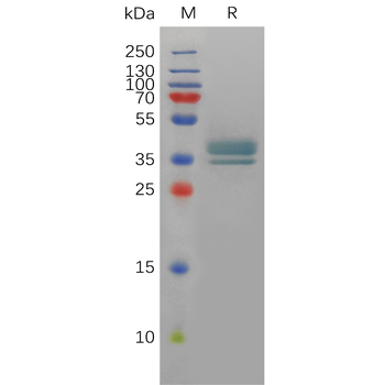 Human IL21R Protein, His Tag