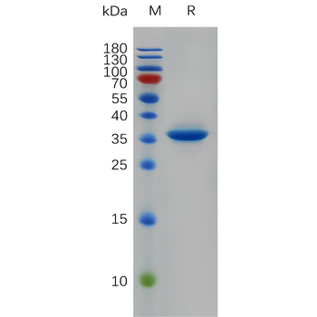 Human IL2 Protein, His Tag