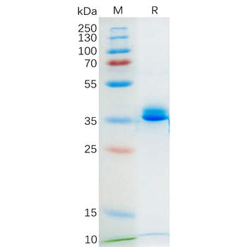 Human PSMA Protein, His Tag