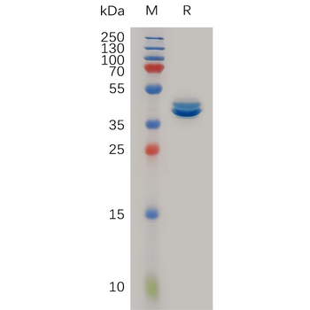 Human YAP1 Protein, His Tag