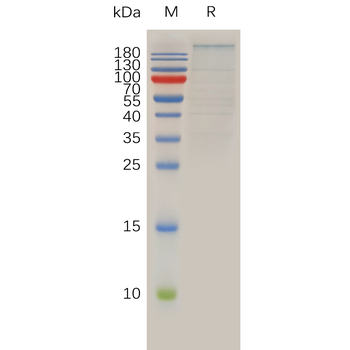 Human SLAMF3 Protein, His Tag