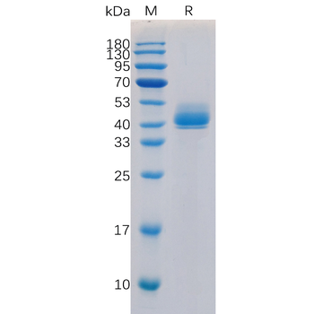 Human IL21R Protein, hFc Tag