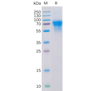 Human IL2 Protein, hFc Tag