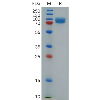 Human CLEC2D Protein, N-His Tag