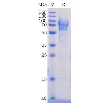 Human ALK Protein, hFc Tag