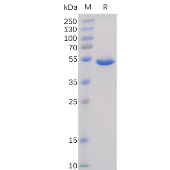 Human ADAM9 Protein, hFc Tag