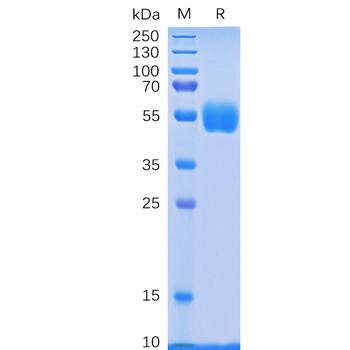 Human CCR4 Protein, hFc Tag