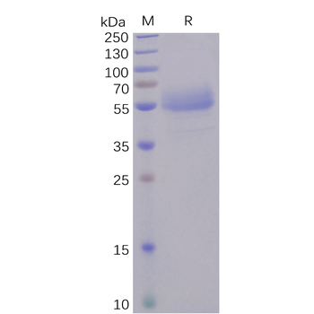 Human PTK7 Protein, hFc Tag