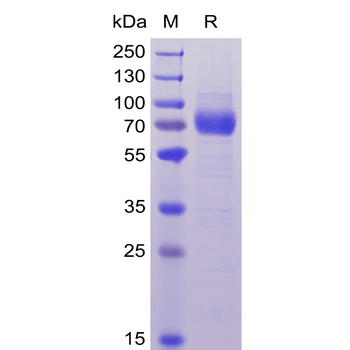 Human TGFB1 Protein, hFc Tag