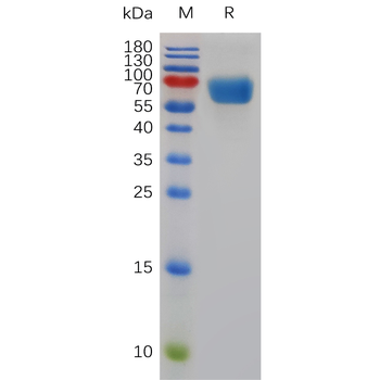 Human CD94 Protein, hFc Tag