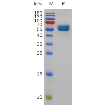 Human PYY Protein, hFc Tag