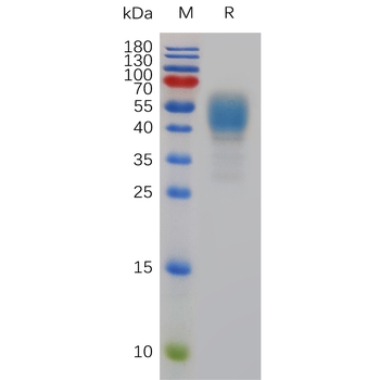 Human RETN Protein, hFc Tag