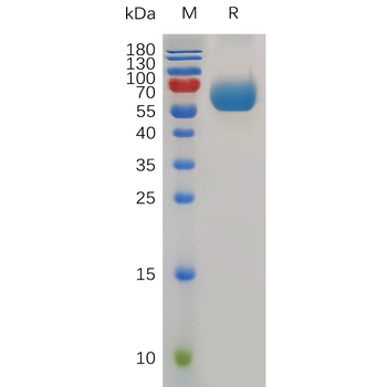Human PPT1 Protein, His Tag