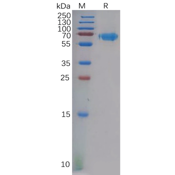 Human CXCR3 Protein, mFc Tag