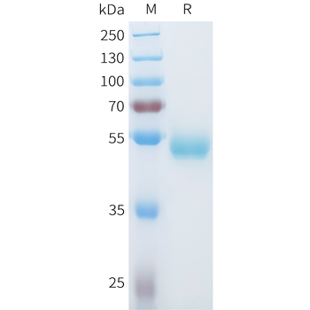 Mouse EGFR Protein, His Tag