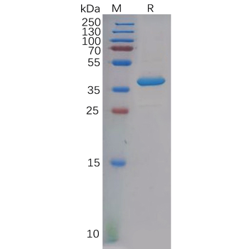 Human SLPI Protein, hFc Tag