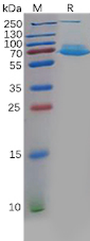 Human MFAP5 Protein, hFc Tag