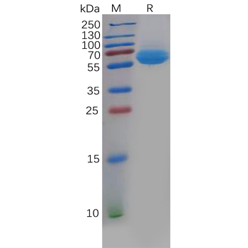 Human LTBR Protein, hFc Tag