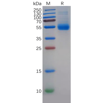 Human CLDN2 Protein, hFc Tag