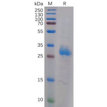 Human RSPO1(21-263) Protein, His Tag