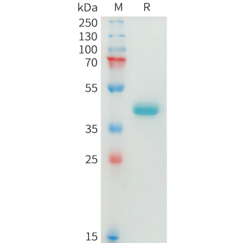Human QSOX1 Protein, His Tag